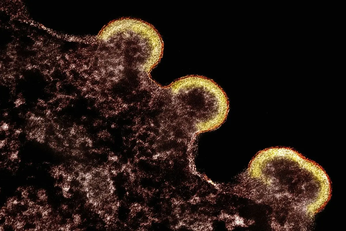 La Peste | Albert Camus anticipa le pandemie di questo secolo